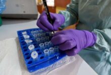 Photo of Nigeria takes emergency action over deadly Lassa Fever